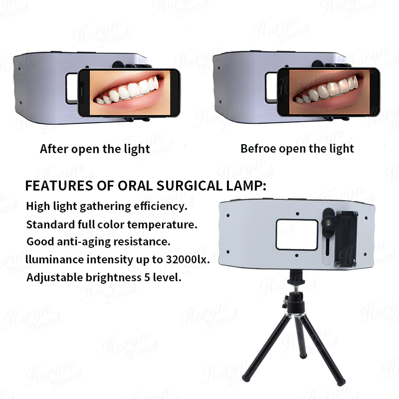 Dental Blitzlicht Fotografie A – Photography Lighting Equipment Bewertung und Preis